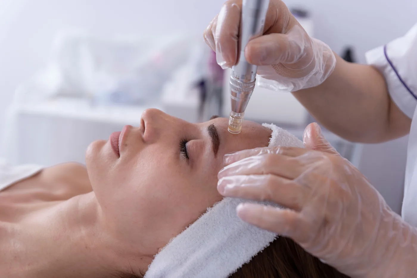 Clinician performing microneedling on a woman’s forehead