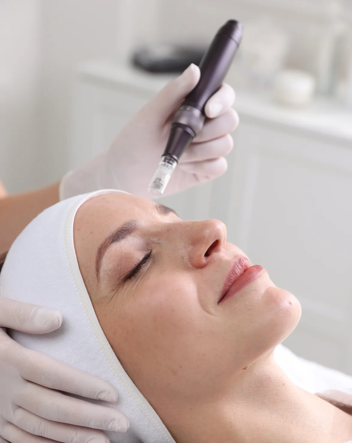 Woman relaxing during a microneedling treatment