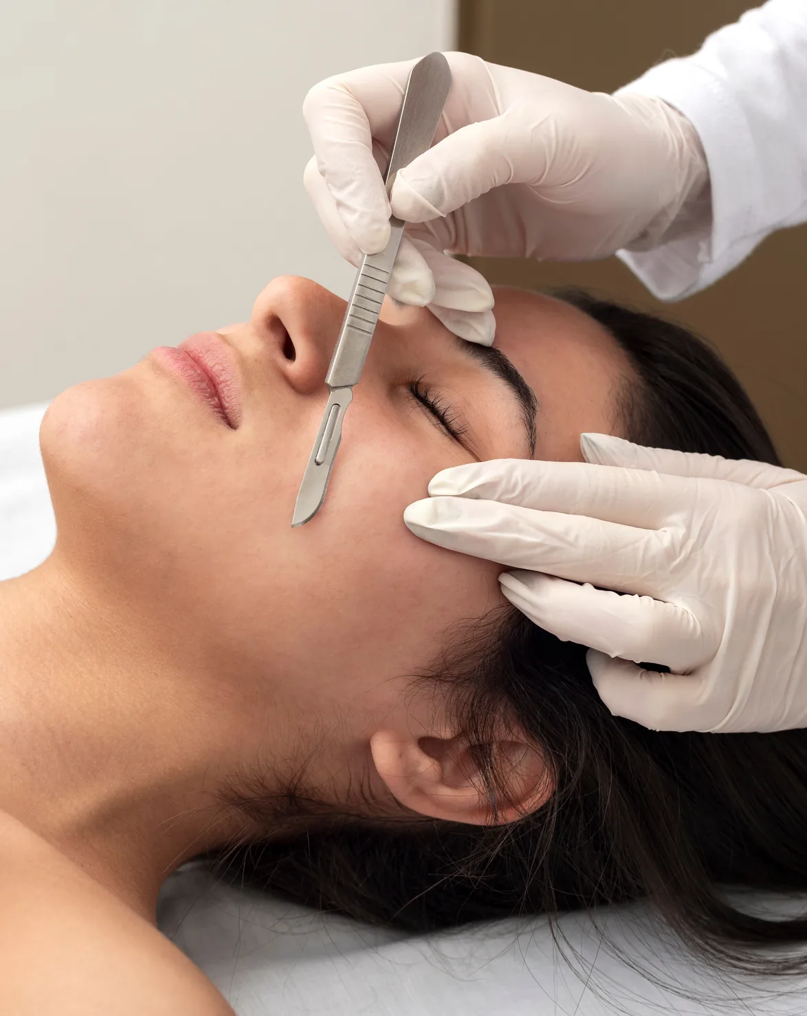 Microplaning treatment performed with a fine blade